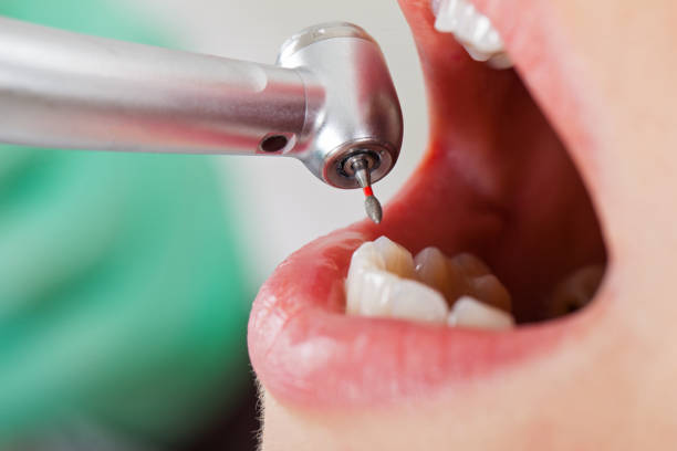 Best Pediatric Emergency Dentist in La Crescenta Montrose, CA